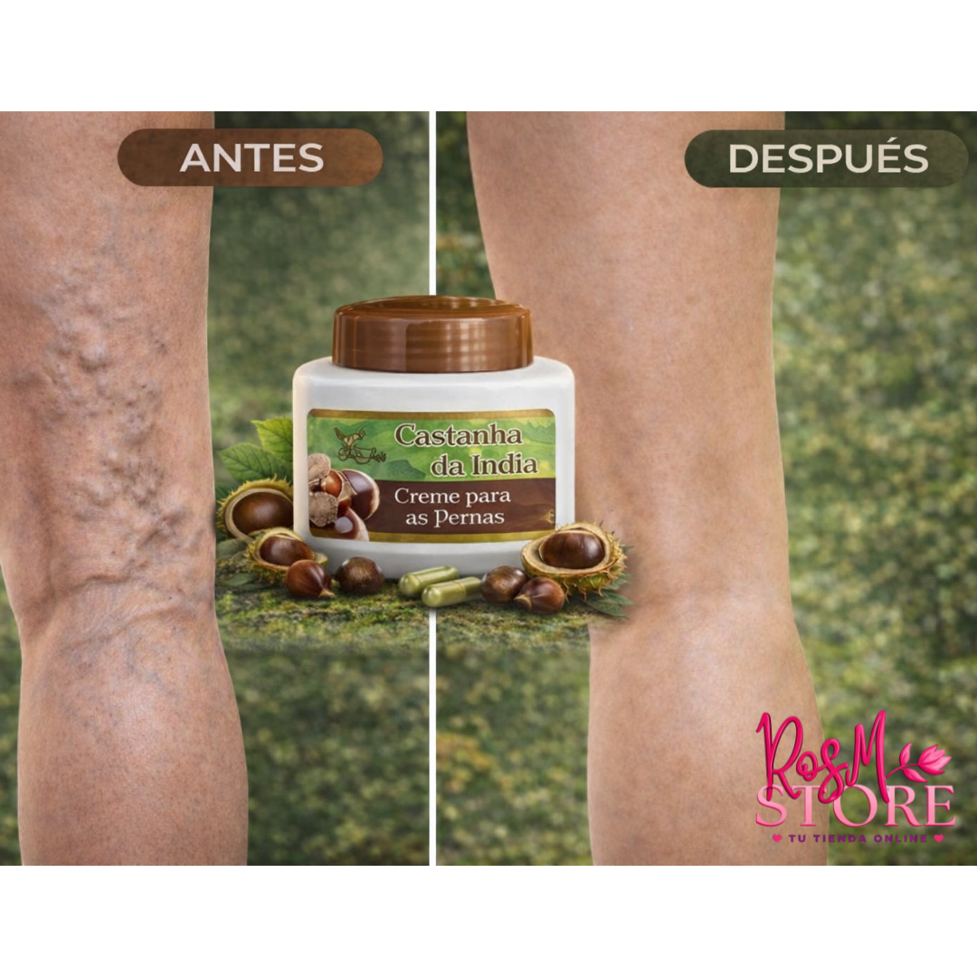 Piernas ligeras sin varices