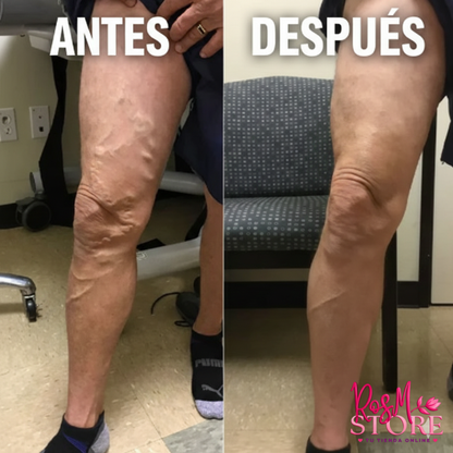 Piernas Ligeras En Minutos